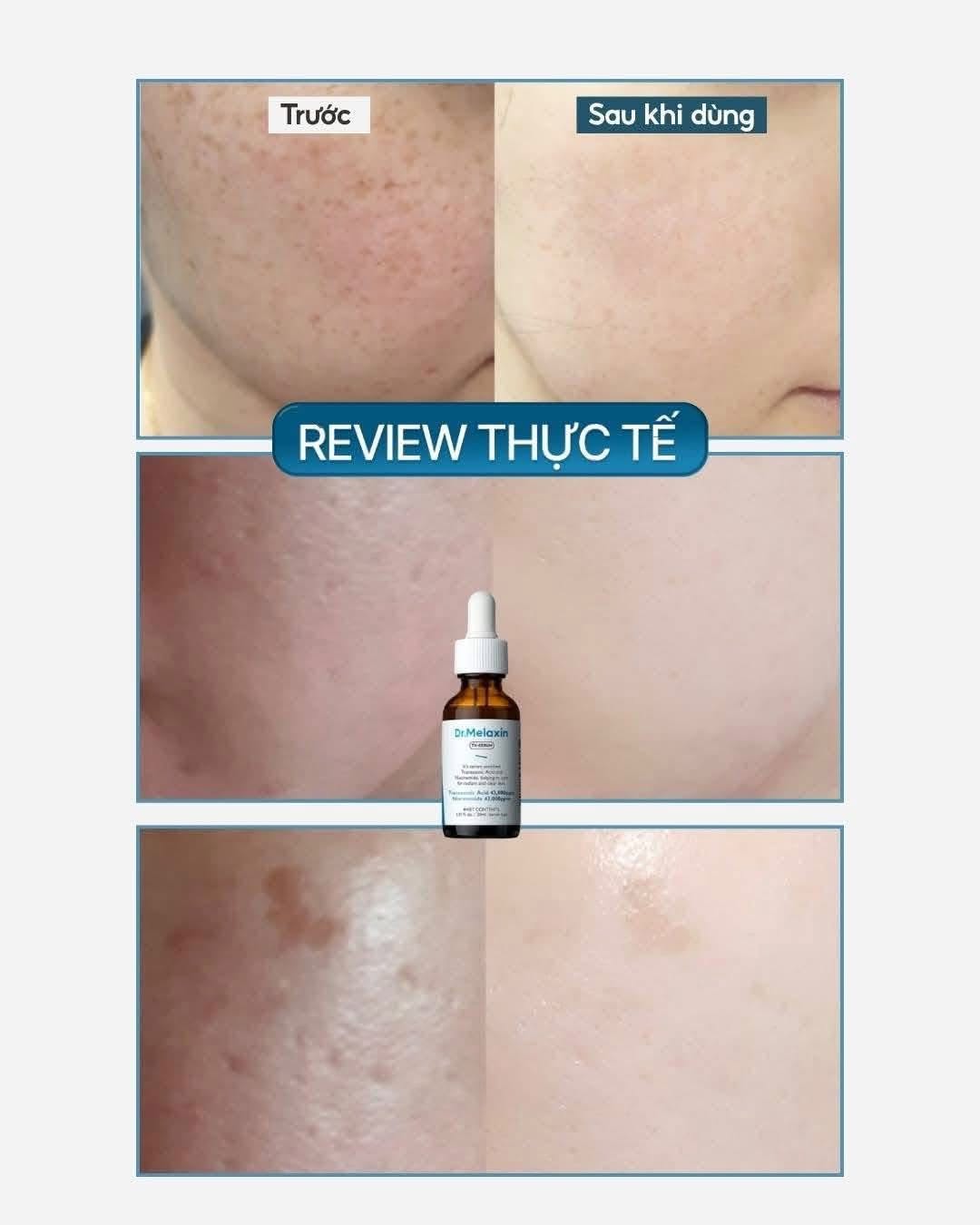 serum dr