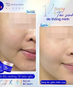 bo doi tai sinh thong minh 82x ai stem cell serum cream 7