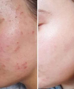 serum carenel niacinamide 10 zinc 1 9
